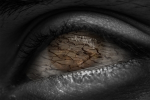 Smoking can cause or exacerbate dry eye symptoms